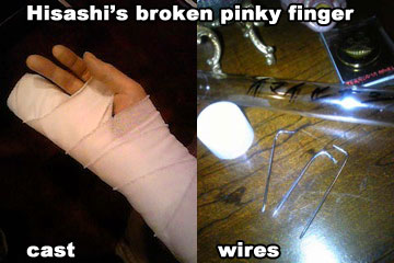 Hisashi injury